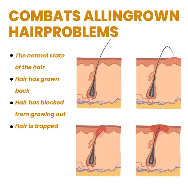 Bikini Area Hair Serum for Irritation Relief and Smooth Skin Alvionz.de