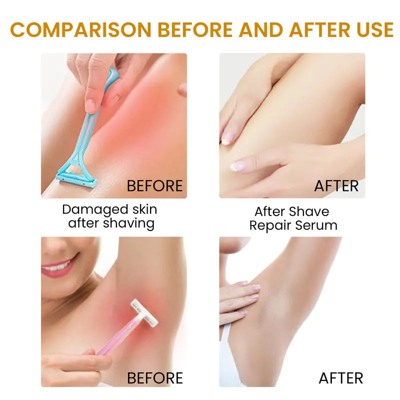 Bikini Area Hair Serum for Irritation Relief and Smooth Skin Alvionz.de